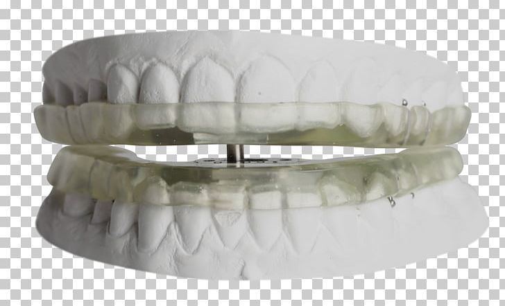 Temporomandibular Joint Dysfunction Orthodontics Dentistry Mouthguard PNG, Clipart, Appliances, Dentistry, Furniture, Miscellaneous, Orthodontics Free PNG Download