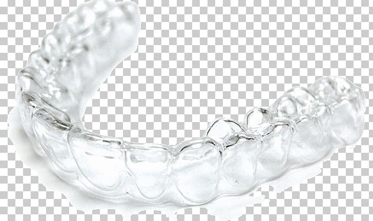 Clear Aligners 3D Printing Polaris Dental Care Dentistry PNG, Clipart, 3d Printing, Align Technology, Bangle, Body Jewelry, Bracelet Free PNG Download