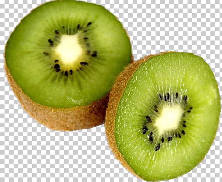 Kiwifruit Diabetes Mellitus Auglis Blood Sugar PNG, Clipart, Auglis, Cartoon Kiwi, Decoration, Diet, Diet Food Free PNG Download