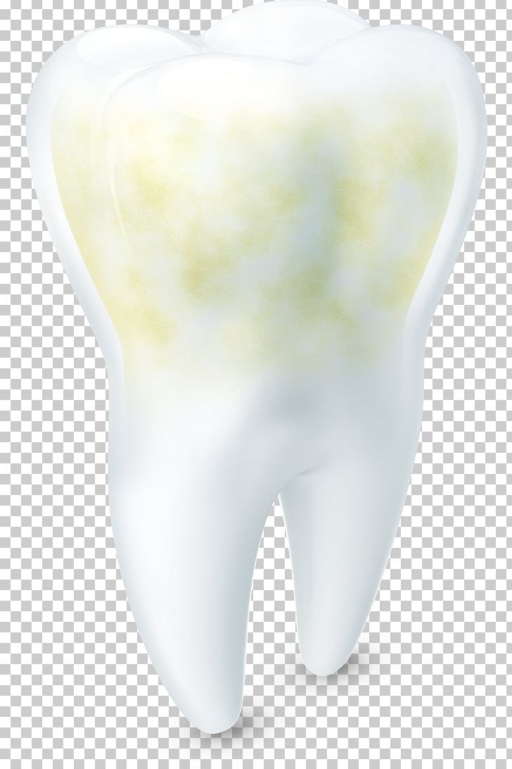 Tooth Enamel Tooth Wear Tooth Decay Acid PNG, Clipart, Acid, Bone, Com, Email, Faq Free PNG Download