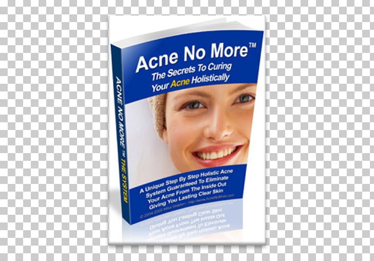 Acne E-book Review Therapy PNG, Clipart, Acne, Author, Barnes Noble, Book, Book Review Free PNG Download