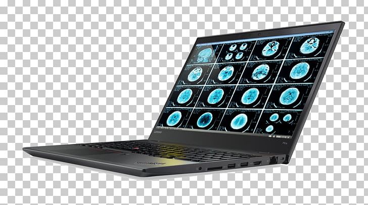 ThinkPad W Series Laptop Intel Lenovo Workstation PNG, Clipart, Brands, Central Processing Unit, Computer Performance, Electronics, Independent Software Vendor Free PNG Download