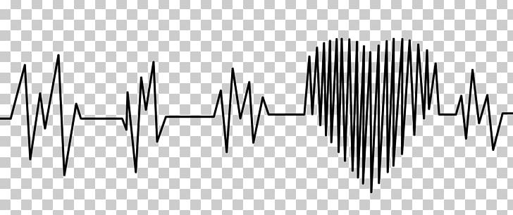 Electrocardiography Heart Rate Acute Myocardial Infarction PNG, Clipart, Angle, Black And White, Cardiac Muscle, Electrocardiogram, Electrocardiography Free PNG Download