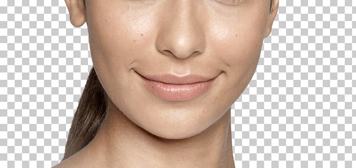 Lip Injectable Filler Restylane Cheek Nose PNG, Clipart, Beauty, Cheek, Chin, Closeup, Collagen Free PNG Download