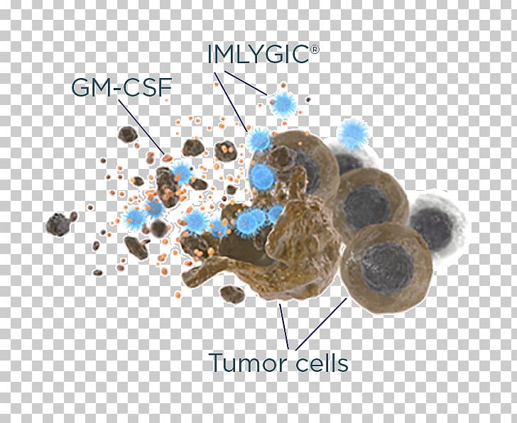Treatment Of Cancer Oncolytic Virus Melanoma PNG, Clipart, Cancer, Cancer Cell, Herpes Simplex, Herpes Simplex Virus, Immune System Free PNG Download