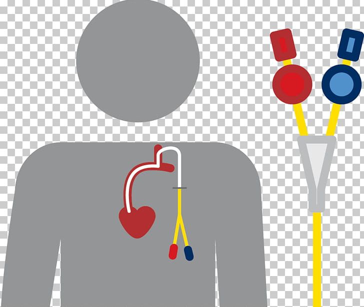 Fistula Catheter