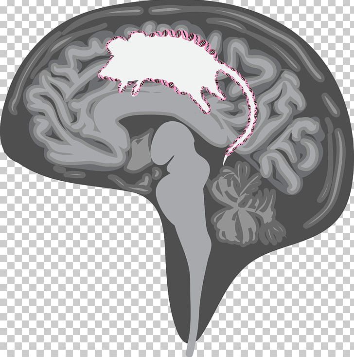 Jellyfish Medusa Tentacle Symbol Brain PNG, Clipart, Alzheimer, Banner, Basics, Brain, Cartoon Free PNG Download