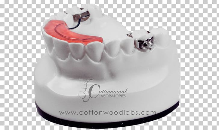Biting Tooth Behavior Dentistry PNG, Clipart, Behavior, Biting, Cake, Chart, Dental Assistant Free PNG Download