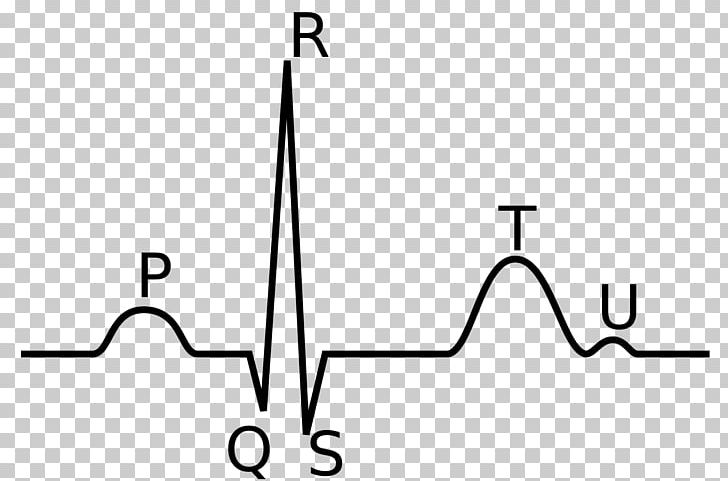 QRS Complex Electrocardiography P Wave Heart Depolarization PNG, Clipart, Angle, Area, Atrium, Black And White, Cardiology Free PNG Download