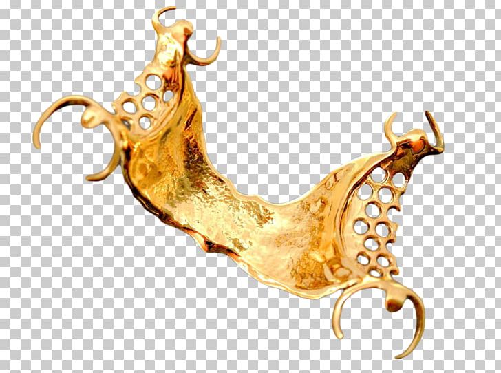 Gold Removable Partial Denture Dentures Crown Dentistry PNG, Clipart, Biocompatibility, Body Jewelry, Crown, Dental Laboratory, Dentistry Free PNG Download