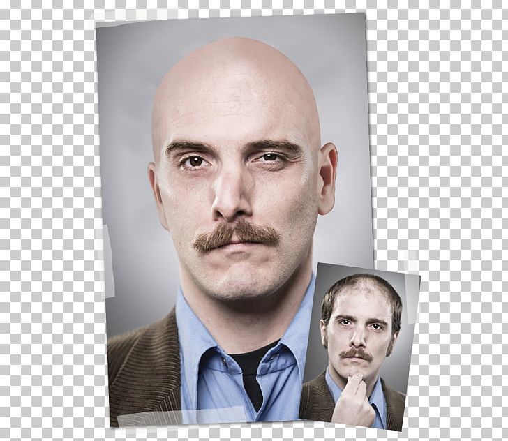 Moustache Stock Photography Portrait PNG, Clipart, Bald Head, Beard, Chin, Emoticon, Face Free PNG Download
