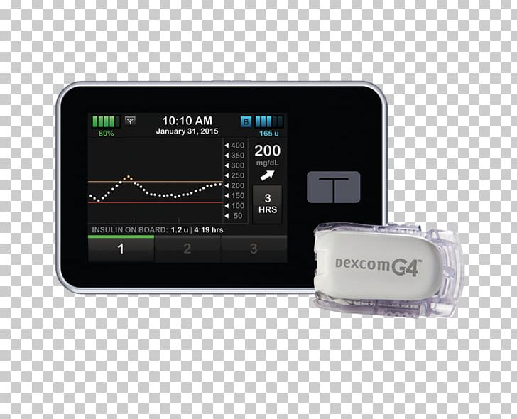 Dexcom Continuous Glucose Monitor Insulin Pump Blood Glucose Monitoring Diabetes Mellitus PNG, Clipart, Animas Corporation, Complications Of Diabetes Mellitus, Continuous Glucose Monitor, Dexcom, Diabetes Mellitus Free PNG Download