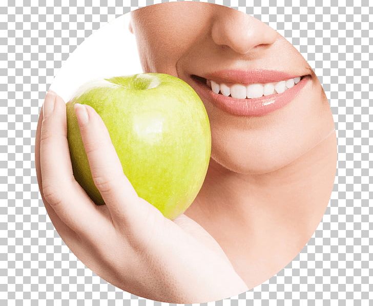 Tooth Dentistry Stock Photography PNG, Clipart, Apple, Chin, Dentist, Dentistry, Diet Food Free PNG Download