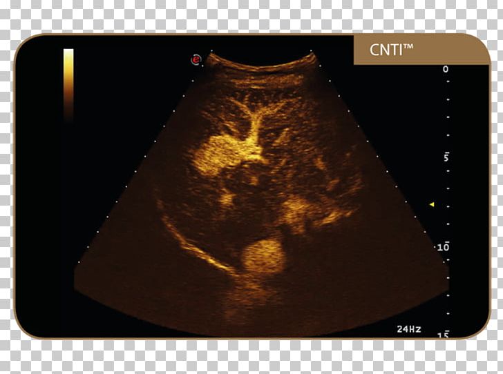 Esaote Ultrasonography Contrast-enhanced Ultrasound Contrast Agent PNG, Clipart, 3d Ultrasound, Brand, Console, Contrast, Contrast Agent Free PNG Download