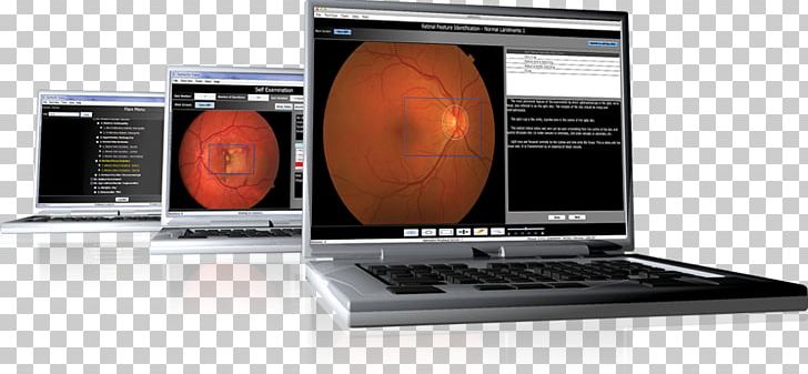 Laptop Multimedia PNG, Clipart, Computer Monitors, Electronics, Examination, Feature, Glaucoma Free PNG Download