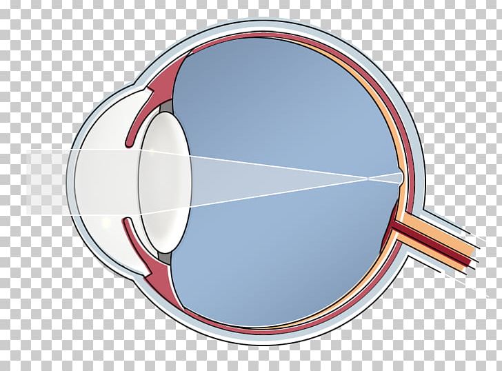 Epi-LASIK Human Eye Hypermetropia Blind Spot PNG, Clipart, Blind Spot, Circle, Cornea, Epilasik, Eye Free PNG Download