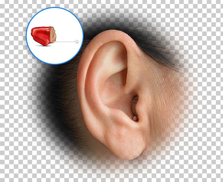 Hearing Aid Hearing Test Audiology PNG, Clipart, Amplifon, Audiology, Chin, Closeup, Ear Free PNG Download