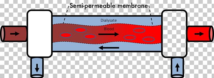 Hemodialysis Transmembrane Protein Pressure PNG, Clipart, Angle, Area, Calculation, Clearance, Cost Free PNG Download