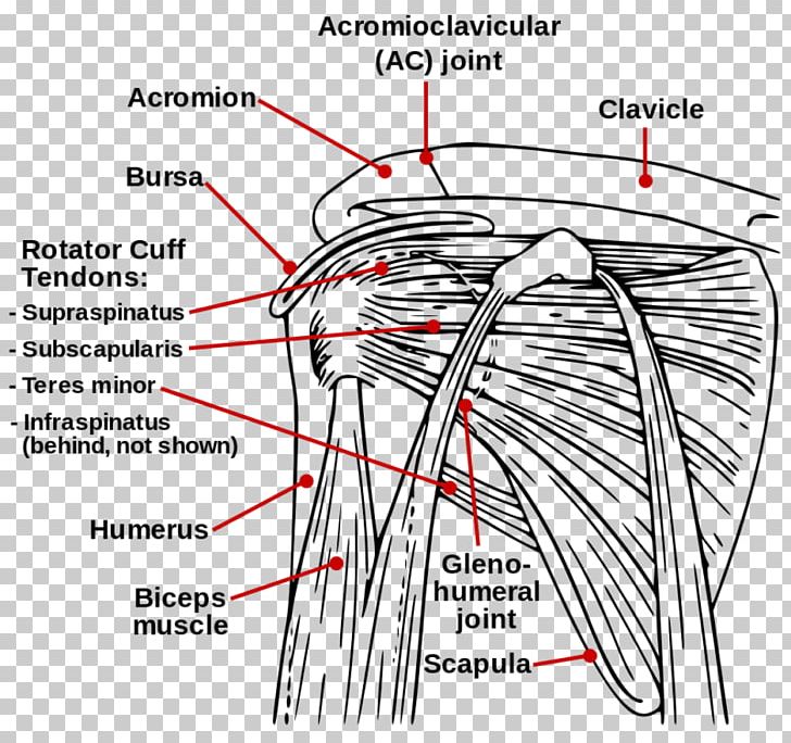 Rotator Cuff Tear Rotator Cuff Injury Muscle Shoulder PNG, Clipart, Angle, Area, Arm, Black And White, Diagram Free PNG Download