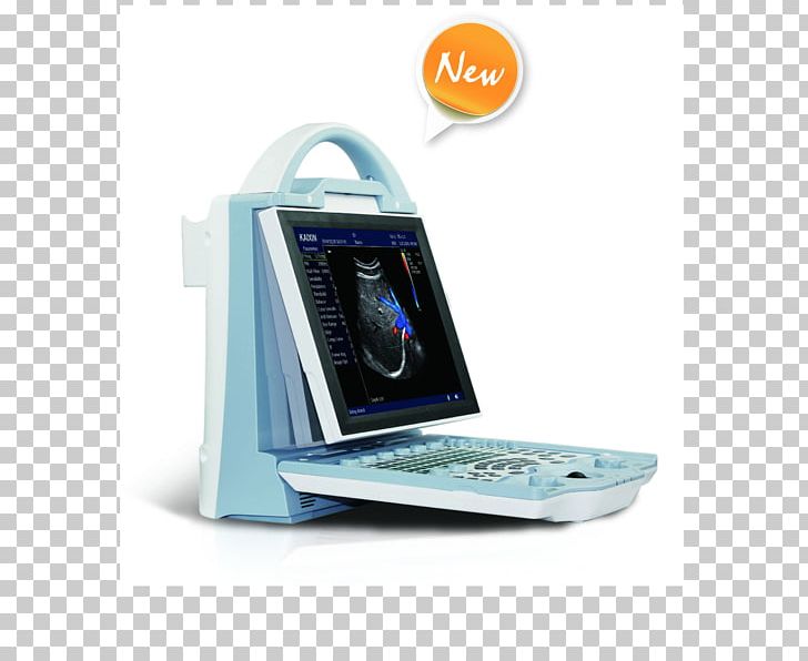 Ultrasonography Portable Ultrasound Doppler Echocardiography Medicine PNG, Clipart, Abdominal Ultrasonography, Doppler Ultrasonography, Electronic Device, Electronics, Gadget Free PNG Download