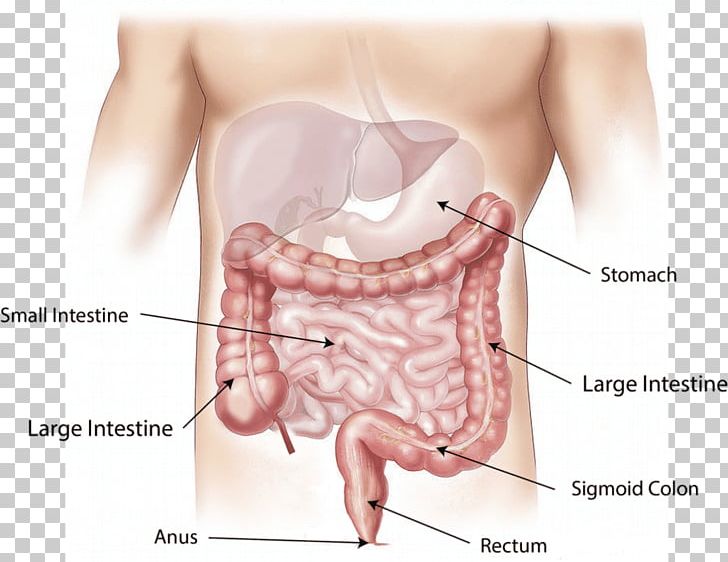 Colorectal Cancer Large Intestine Colorectal Surgery Rectum PNG, Clipart, Abdomen, Anatomy, Cancer, Cancer Screening, Causes Of Cancer Free PNG Download