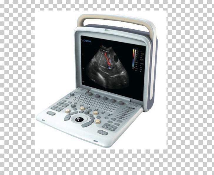 Ultrasonography Portable Ultrasound Obstetrics And Gynaecology Radiology PNG, Clipart, Doppler Echocardiography, Electronics, Medical Diagnosis, Medical Equipment, Medical Imaging Free PNG Download