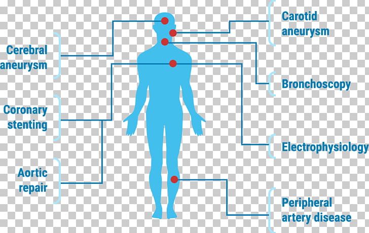 Centerline Biomedical PNG, Clipart, Angle, Area, Arm, Biomedical Engineering, Body Free PNG Download