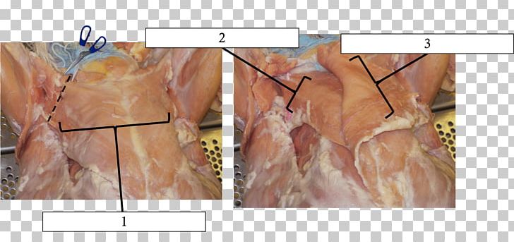 Common Iliac Artery Femoral Artery Vein Inferior Vena Cava Common Carotid Artery PNG, Clipart, Abdominal, Anatomy, Angle, Aorta, Blood Free PNG Download