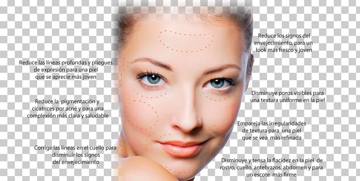 Facial Face Wrinkle Skin Photorejuvenation PNG, Clipart, Ageing, Antiaging Cream, Beauty, Beauty Parlour, Botulinum Toxin Free PNG Download