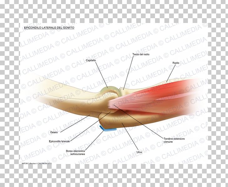 Lateral Epicondyle Of The Humerus Tennis Elbow Medial Epicondyle Of The Humerus PNG, Clipart, Anatomy, Angle, Bone, Elbow, Epicondyle Free PNG Download