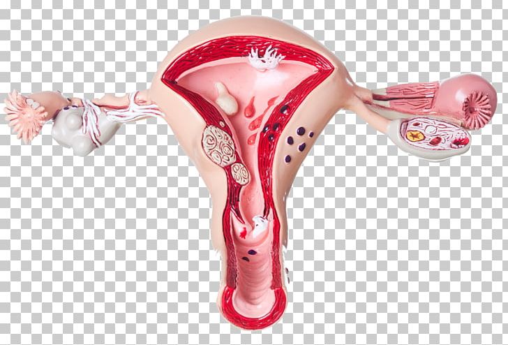 Ovary Ovarian Cyst Pain Uterus Symptom PNG, Clipart, Celebrities, Cyst, Eggs, Fallopian Tube, Female Hair Free PNG Download