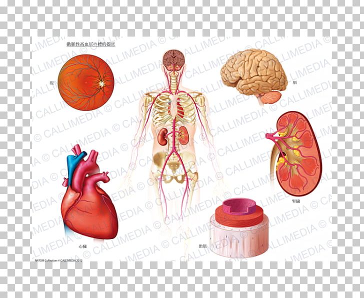 Presio Arterial Hypertension Artery Ambulatory Blood Pressure Organ PNG, Clipart, Ambulatory Blood Pressure, Artery, Blood Pressure, Circulatory System, Health Free PNG Download