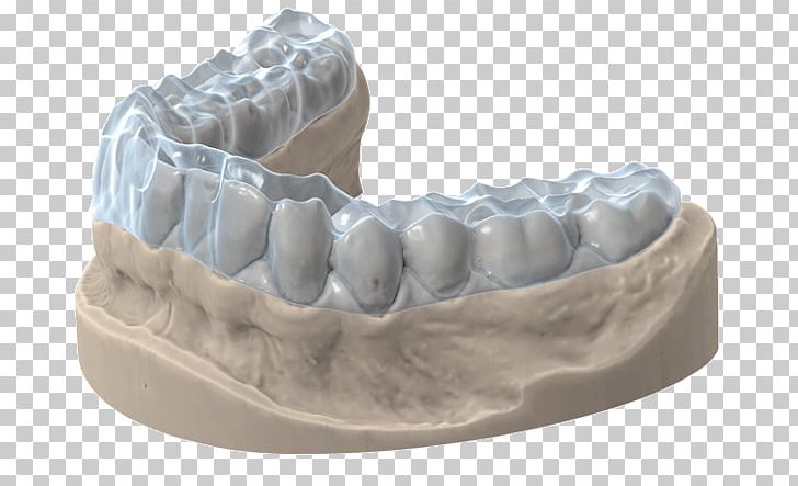 3D Scanner Tooth Computer Software Scanner 3D Printing PNG, Clipart, 3d Printing, 3d Scanner, Articulator, Bite, Cad Free PNG Download