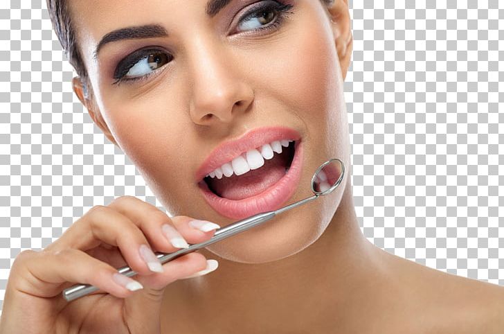 Cosmetic Dentistry Dental Implant Dental Surgery PNG, Clipart, Baby Teeth, Beauty, Bridge, Cheek, Chin Free PNG Download