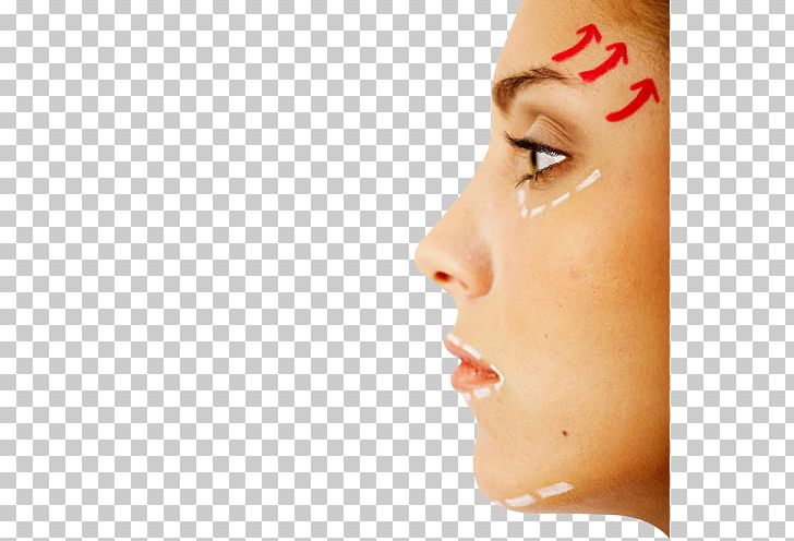 Face Surgery Nose Stock Photography Rhinoplasty PNG, Clipart, Blepharoplasty, Business Woman, Cheek, Chin, Closeup Free PNG Download