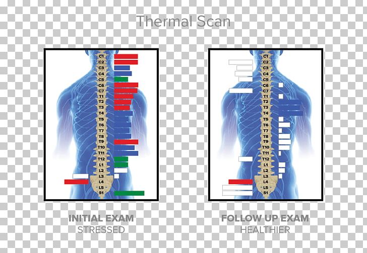 McKillican Chiropractic Chiropractor Nervous System Technology PNG, Clipart, Adaptation, Angle, Brand, Chiropractic, Chiropractor Free PNG Download