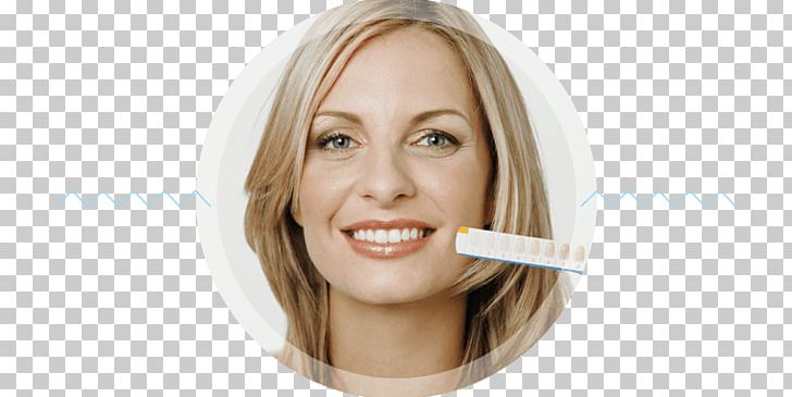Bleach Tooth Whitening Cosmetic Dentistry PNG, Clipart, Bleach, Blond, Brown Hair, Cheek, Chin Free PNG Download