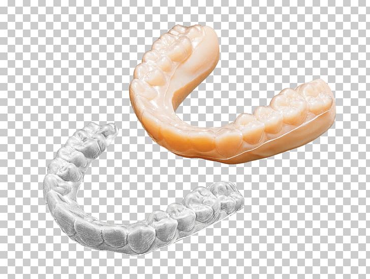 Jaw Human Tooth Bergamo Accessori Srl Dentistry PNG, Clipart, 3d Printing, Anatomy, Body Jewellery, Body Jewelry, Clear Aligners Free PNG Download