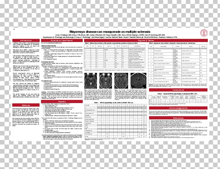 Multiple Sclerosis Moyamoya Disease Immune-mediated Inflammatory Diseases PNG, Clipart, Area, Artery, Brain, Brand, Case Report Free PNG Download