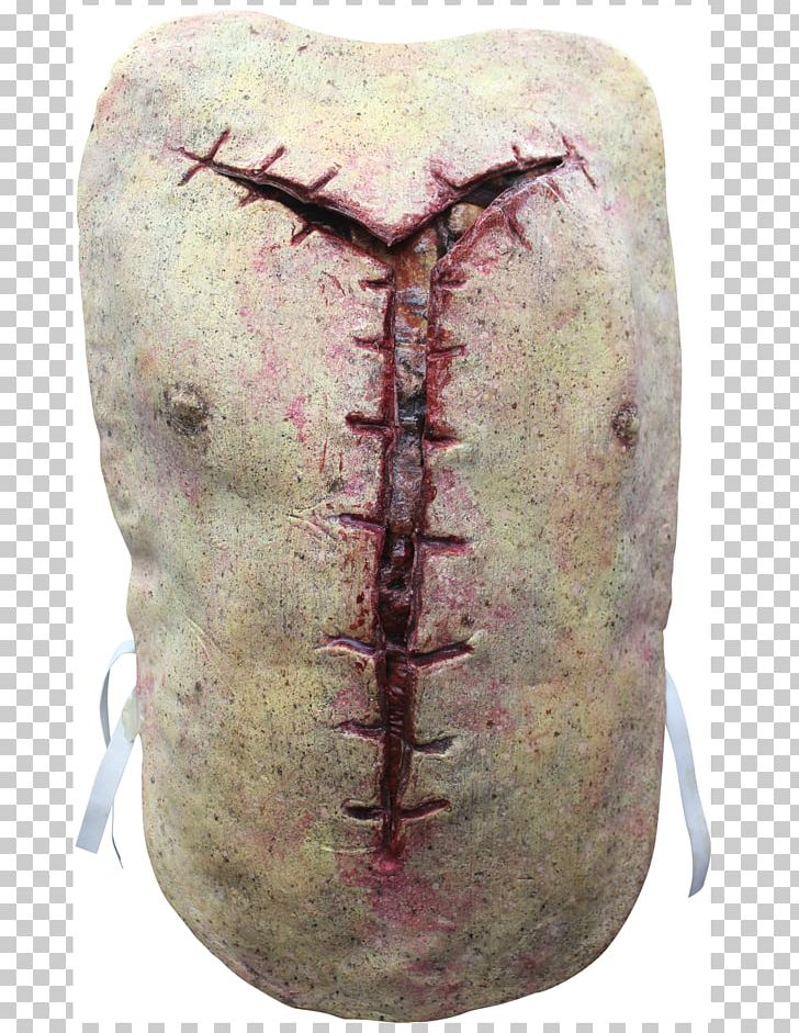 Putred Offal Mature Necropsy Autopsy Garroting Way Purulent Cold PNG, Clipart, Album, Artifact, Autopsy, Cadaver, Garroting Way Free PNG Download