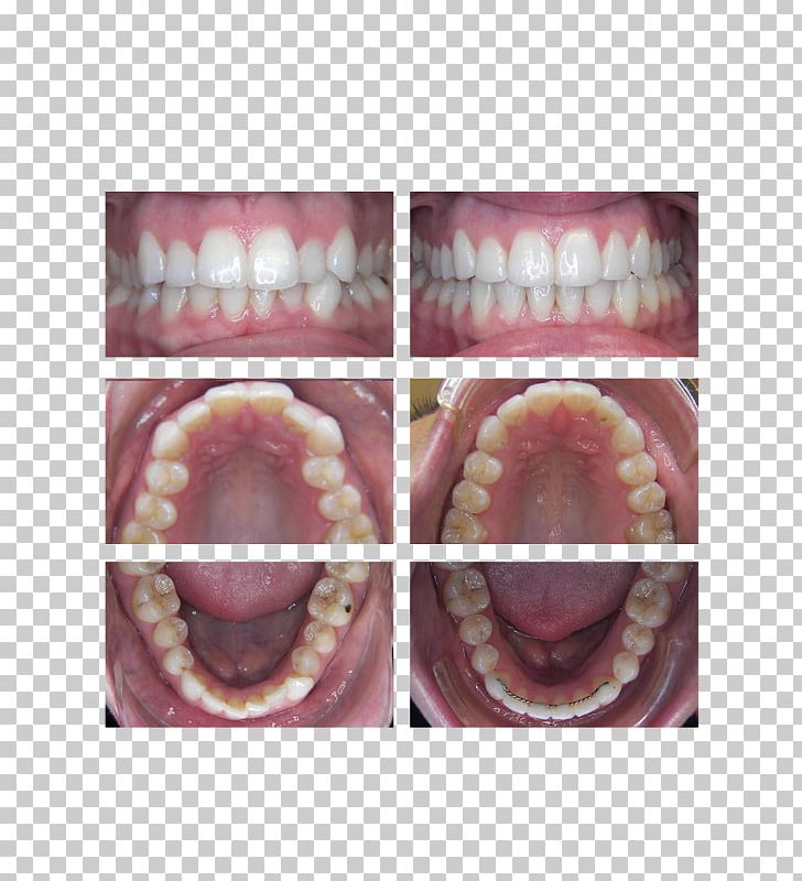 Close-up PNG, Clipart, Chris Pugeda Dmd, Closeup, Closeup, Cosmetic Dentistry, Dentistry Free PNG Download