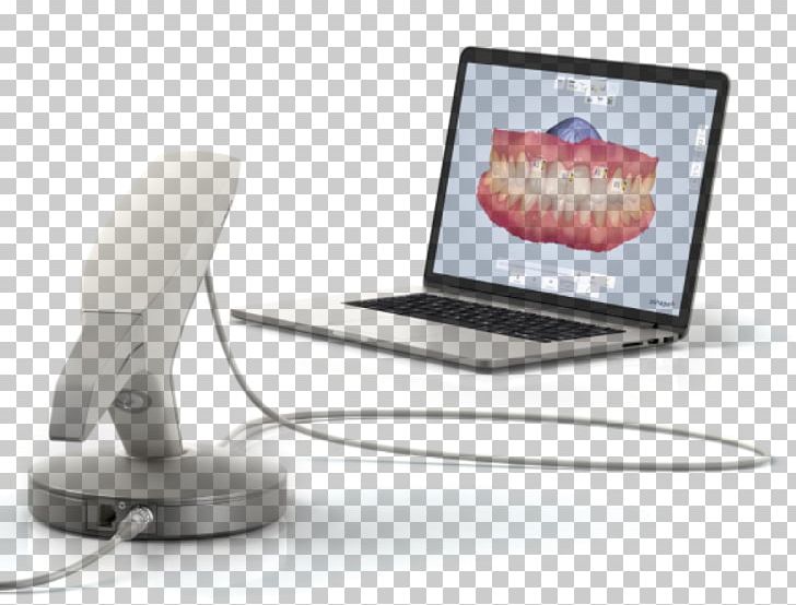3Shape Dentistry Scanner 3D Scanner PNG, Clipart, 3 Shape, 3d Scanner, 3shape, Cadcam Dentistry, Dental Free PNG Download