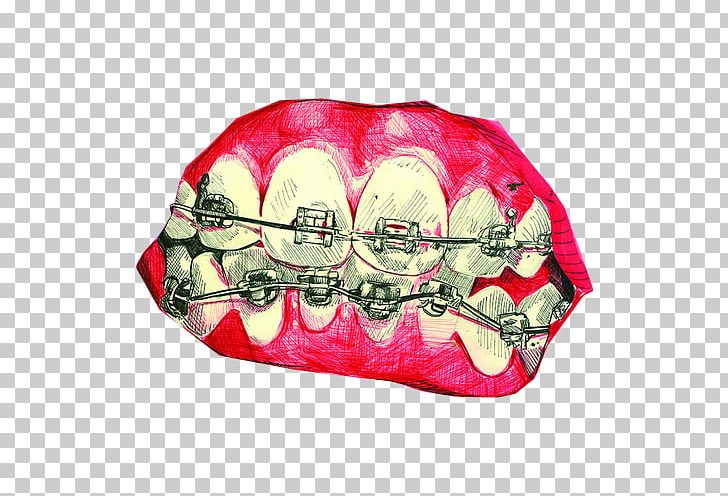 Mouth Tooth Sinful Folk: A Novel Of The Middle Ages Dental Braces PNG, Clipart, Braces, Data, Data Compression, Dental Braces, Dentistry Free PNG Download