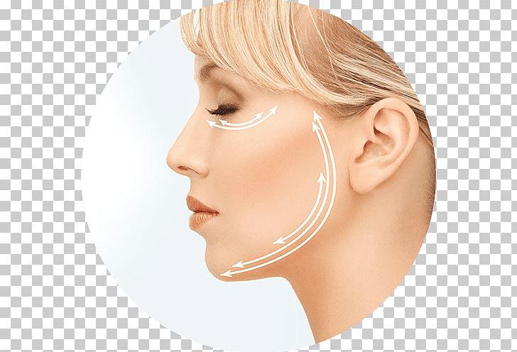Rhytidectomy Surgical Suture Surgery Rejuvenation Therapy PNG, Clipart, Beauty, Cheek, Chin, Cosmetic Surgery, Dentistry Free PNG Download