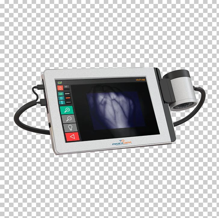 Light Near-infrared Vein Finder Touchscreen PNG, Clipart, Blood, Body, Computer Monitors, Electronic Device, Electronics Free PNG Download