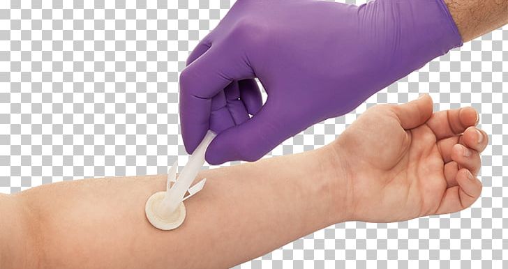Milliliter CareFusion Becton Dickinson Vial Celebrity PNG, Clipart, Ampoule, Antiseptic, Arm, Becton Dickinson, Carefusion Free PNG Download