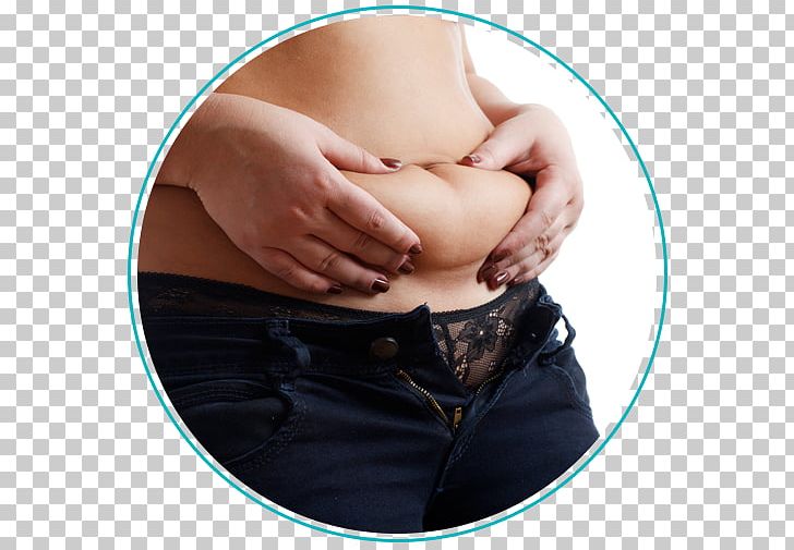 Abdominal Obesity Abdomen Weight Loss Cryolipolysis PNG, Clipart, Abdomen, Abdominal Obesity, Abdominal Tenderness, Adipose Tissue, Arm Free PNG Download