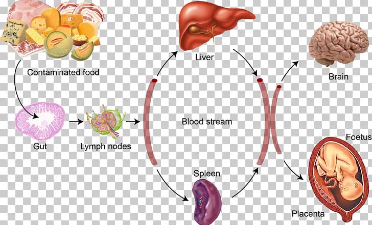 Listeria Monocytogenes Listeriosis Infection Bacteria Food Poisoning PNG, Clipart, Bacteria, Brain, Cause, Disease, Ear Free PNG Download