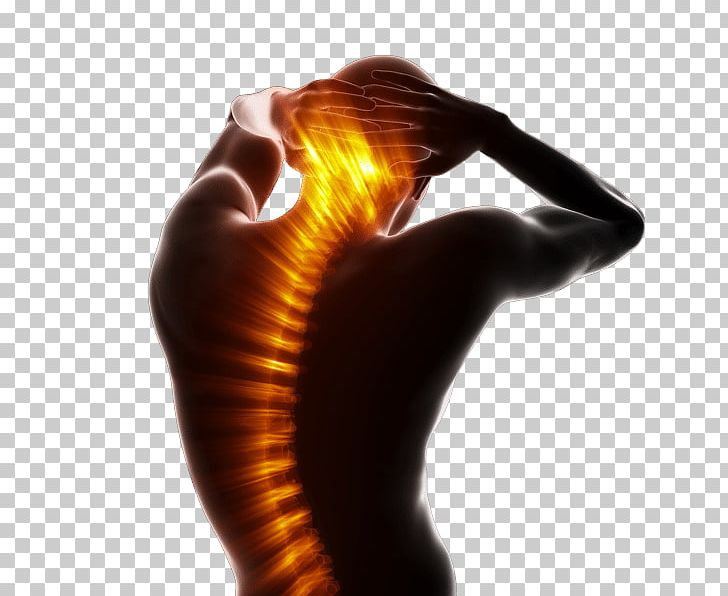 Massage Chiropractic Therapy Surgery Neck Pain PNG, Clipart, Arm, Back Pain, Chiropractic, Chiropractor, Discectomy Free PNG Download