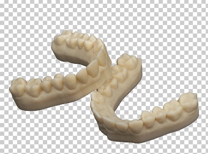 3D Printing Dentistry Dental Composite Crown PNG, Clipart, 3d Printing, Acrylonitrile Butadiene Styrene, Crown, Dental Composite, Dental Impression Free PNG Download